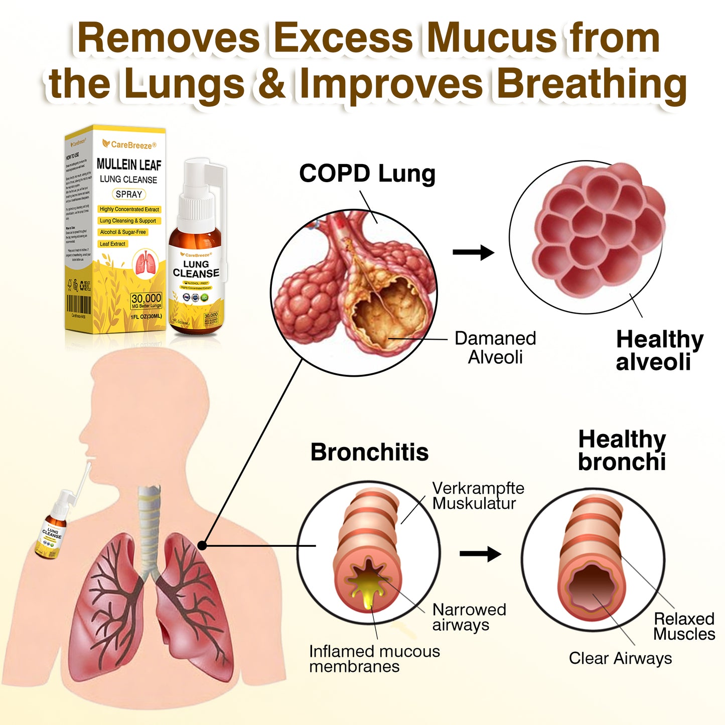 💖✅Official Store:CareBreeze® Botanical Mullein Leaf Extract Lung Cleanse Spray（💛Directly acts on COPD, asthma, chronic bronchitis (CB), respiratory infections, lung cancer, sinusitis, and other conditions💛）