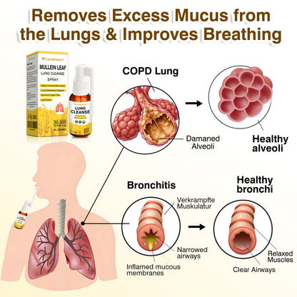 💖✅Official Store:CareBreeze® Botanical Mullein Leaf Extract Lung Cleanse Spray（💛Directly acts on COPD, asthma, chronic bronchitis (CB), respiratory infections, lung cancer, sinusitis, and other conditions💛）