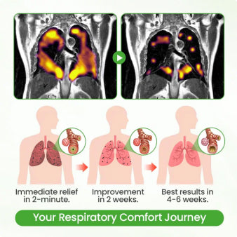🇦🇺👨‍⚕️✅CareBreeze® Botanical Mullein Lung Cleanse Diffuser(🫁Cough, Pharyngitis, shortness of breath, sputum, stuffy nose, bronchitis, bronchitis, allergy symptoms, lung discomfort💝)