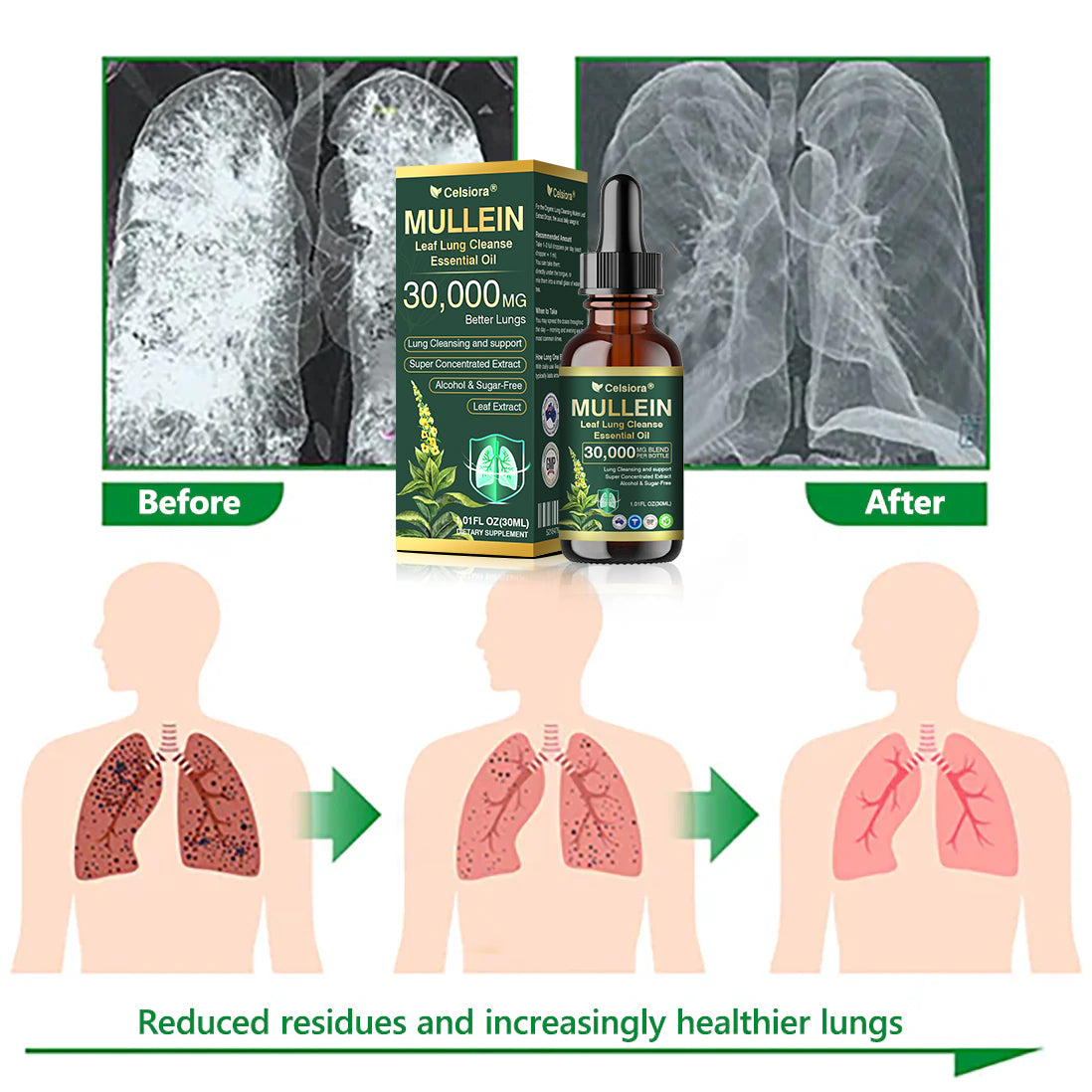💖✅𝐀𝐔 𝐎𝐟𝐟𝐢𝐜𝐢𝐚𝐥 𝐒𝐭𝐨𝐫𝐞|𝐂𝐞𝐥𝐬𝐢𝐨𝐫𝐚® 𝐎𝐫𝐠𝐚𝐧𝐢𝐜 𝐌𝐮𝐥𝐥𝐞𝐢𝐧 𝐋𝐞𝐚𝐟 𝐋𝐮𝐧𝐠 𝐂𝐥𝐞𝐚𝐧𝐬𝐞 𝐄𝐬𝐬𝐞𝐧𝐭𝐢𝐚𝐥 𝐎𝐢𝐥 (🫁Cough, wheezing, shortness of breath, sputum, stuffy nose, bronchitis, bronchitis, allergy symptoms, lung discomfort💝)