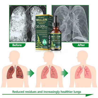 💖✅𝐀𝐔 𝐎𝐟𝐟𝐢𝐜𝐢𝐚𝐥 𝐒𝐭𝐨𝐫𝐞|𝐂𝐞𝐥𝐬𝐢𝐨𝐫𝐚® 𝐎𝐫𝐠𝐚𝐧𝐢𝐜 𝐌𝐮𝐥𝐥𝐞𝐢𝐧 𝐋𝐞𝐚𝐟 𝐋𝐮𝐧𝐠 𝐂𝐥𝐞𝐚𝐧𝐬𝐞 𝐄𝐬𝐬𝐞𝐧𝐭𝐢𝐚𝐥 𝐎𝐢𝐥 (🫁Cough, wheezing, shortness of breath, sputum, stuffy nose, bronchitis, bronchitis, allergy symptoms, lung discomfort💝)