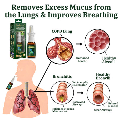 ✅✅🇦🇺 Official Store:CareBreeze® 6-in-1 Herbal BeePropolis Lung Cleanse Spray🐝(⚡Fast Relief 🫁Long-Lasting Benefits)