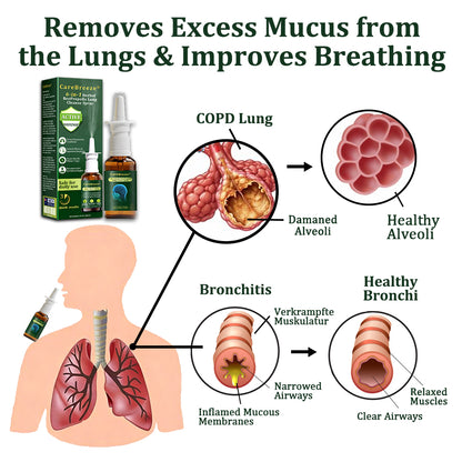 💖🐝✅AU Official Store:CareBreeze® 6-in-1 Herbal BeePropolis Lung Cleanse Spray（👨‍⚕️Directly acts on COPD, asthma, chronic bronchitis (CB), respiratory infections, lung cancer, sinusitis, and other conditions）