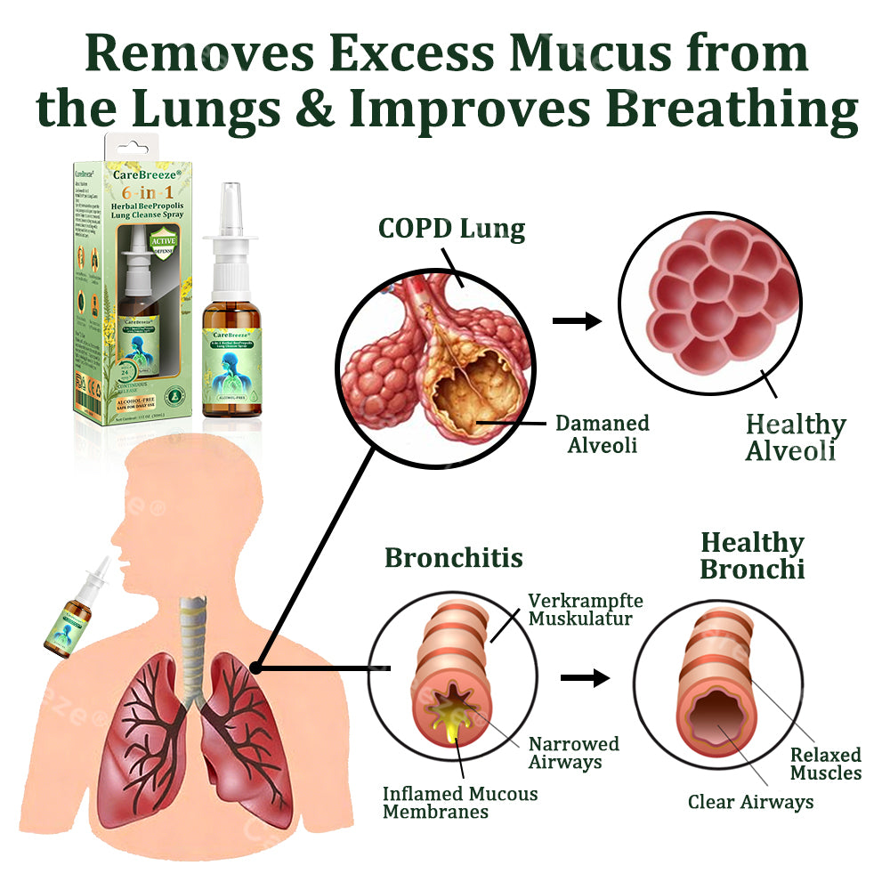 🌱🌱🇦🇺 Official Store:CareBreeze® 6-in-1 Herbal BeePropolis Lung Cleanse Spray🐝(⚡Fast Relief 🫁Long-Lasting Benefits)