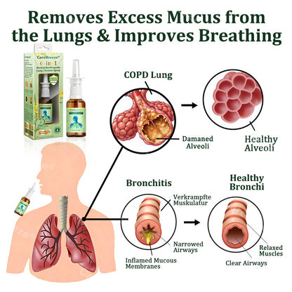 🌱🌱🇦🇺 Official Store:CareBreeze® 6-in-1 Herbal BeePropolis Lung Cleanse Spray🐝(⚡Fast Relief 🫁Long-Lasting Benefits)