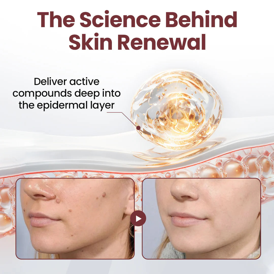 ✅AU Owned and Operated：Pheromex®Dual-Action Plant Wart Removal Cream（👨‍⚕️Skin Tags,Acne,Hyperpigmentation,Eczema,Psoriasis,Rosacea,Warts)