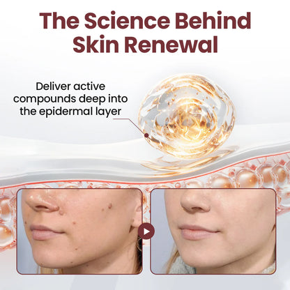 ✅AU Owned and Operated：Pheromex®Dual-Action Plant Wart Removal Cream（👨‍⚕️Skin Tags,Acne,Hyperpigmentation,Eczema,Psoriasis,Rosacea,Warts)