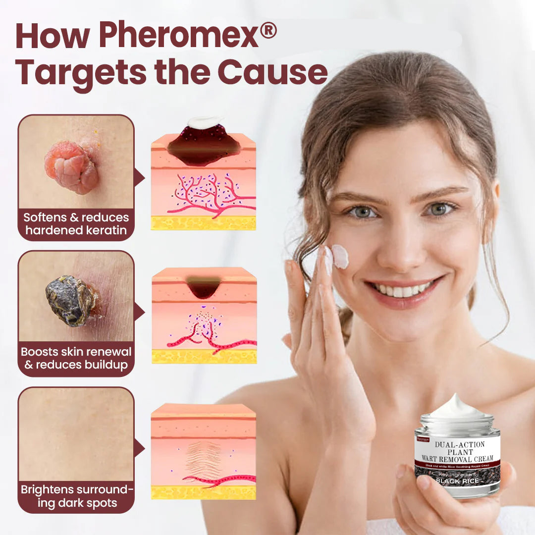 ✅AU Owned and Operated：Pheromex®Dual-Action Plant Wart Removal Cream（👨‍⚕️Skin Tags,Acne,Hyperpigmentation,Eczema,Psoriasis,Rosacea,Warts)