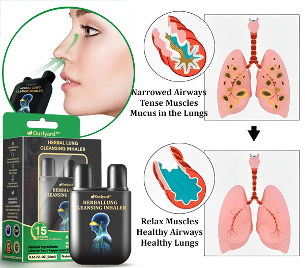 ✅🦘Official Store:Ourlyard™ Herbal Lung Cleansing Inhaler (💝 Cough, wheezing, shortness of breath, sputum, stuffy nose, bronchitis, bronchitis, allergy symptoms, lung discomfort💝)