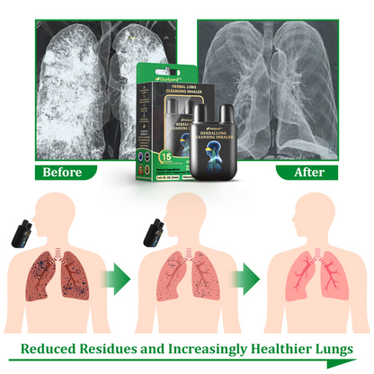 ✅🦘Official Store:Ourlyard™ Herbal Lung Cleansing Inhaler (💝 Cough, wheezing, shortness of breath, sputum, stuffy nose, bronchitis, bronchitis, allergy symptoms, lung discomfort💝)