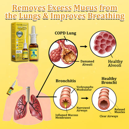 💛🐝✅AU Official Store:CareBreeze® 6-in-1 Herbal BeePropolis Lung Cleanse Spray（👨‍⚕️Directly acts on COPD, asthma, chronic bronchitis (CB), respiratory infections, lung cancer, sinusitis, and other conditions）